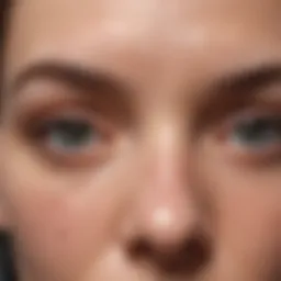 Close-up of forehead skin showing acne breakouts