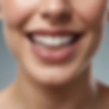 Close-up view of a whitening strip applied to a set of teeth.