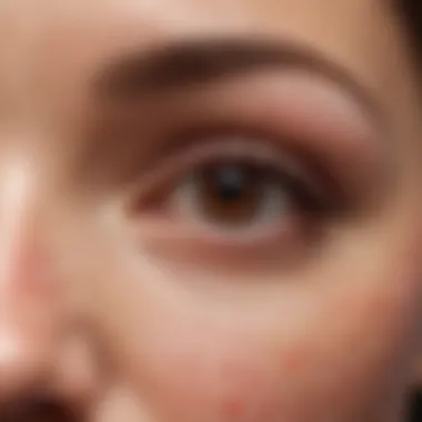 Illustration showing different types of skin conditions causing red bumps